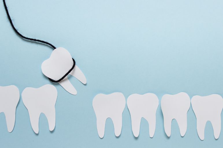 estrazione-dente-del-giudizio-078.jpg