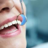 macchioline nere sui denti
