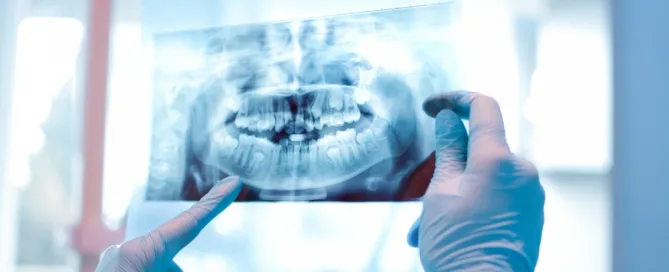 Gnatologia posturale Studi Campagna Dentista Catania