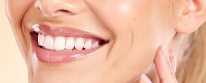 Ortodonzia linguale a Catania