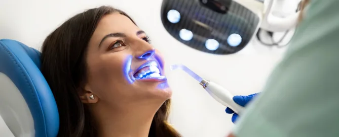 Sbiancamento dentale