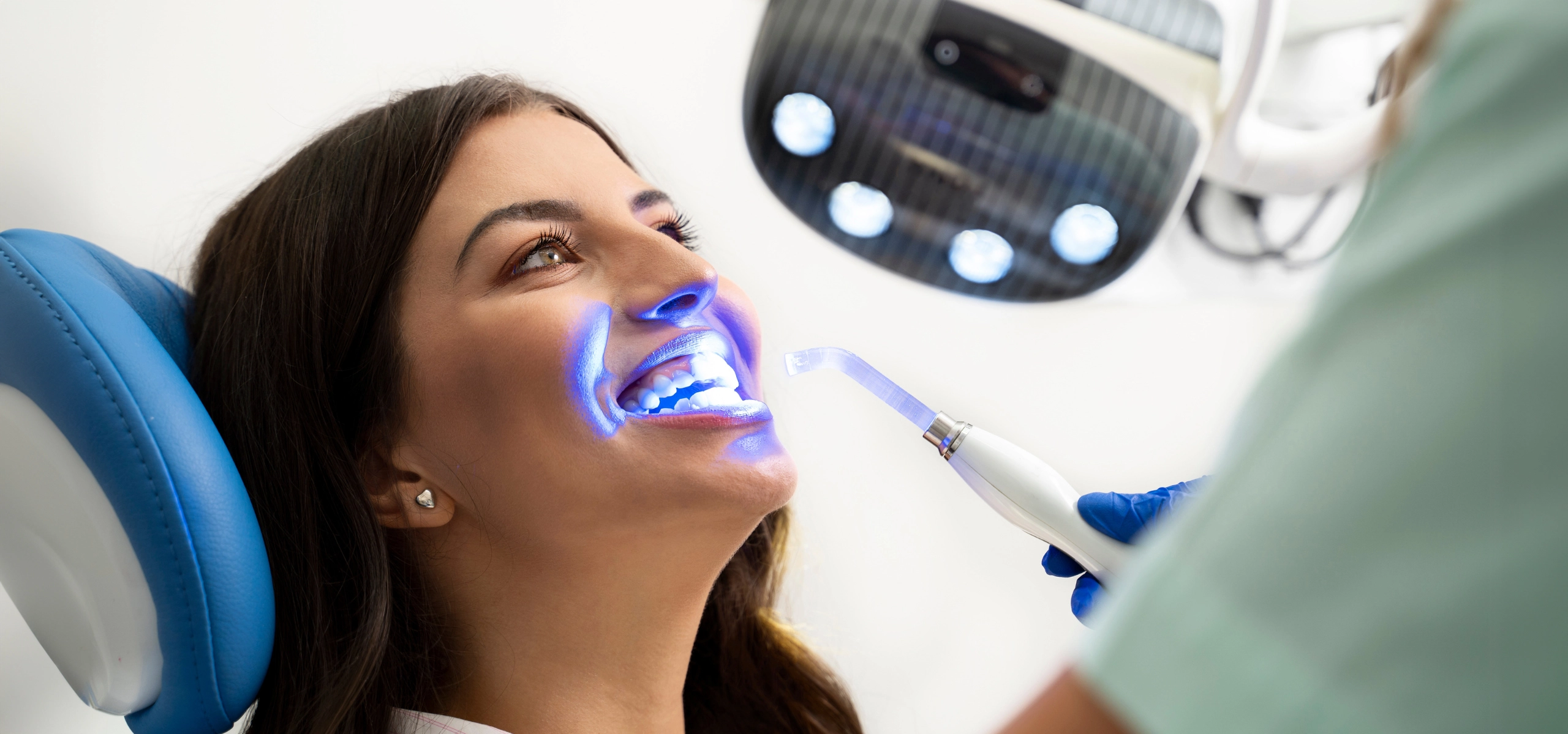 Sbiancamento dentale