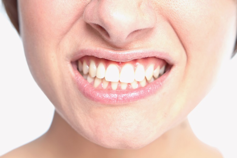 Bruxismo: quando lo stress influenza la salute dei tuoi denti