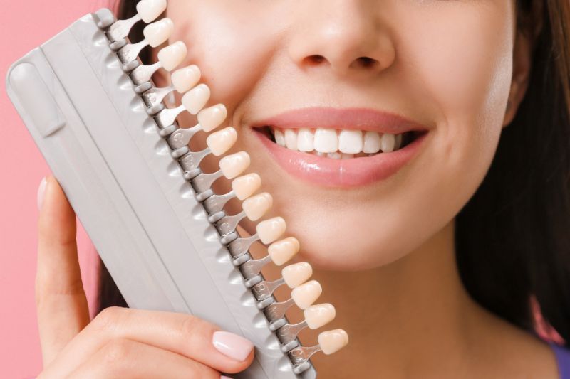 Cura dei denti: 5 consigli per prenderti cura dei tuoi denti durante l’estate