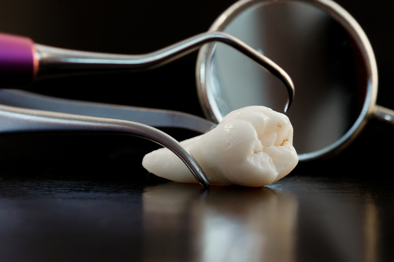 Denti del giudizio: perché arrivano così tardi?