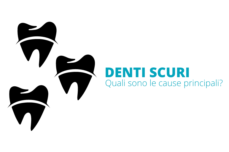 Denti scuri: quali sono le cause principali?