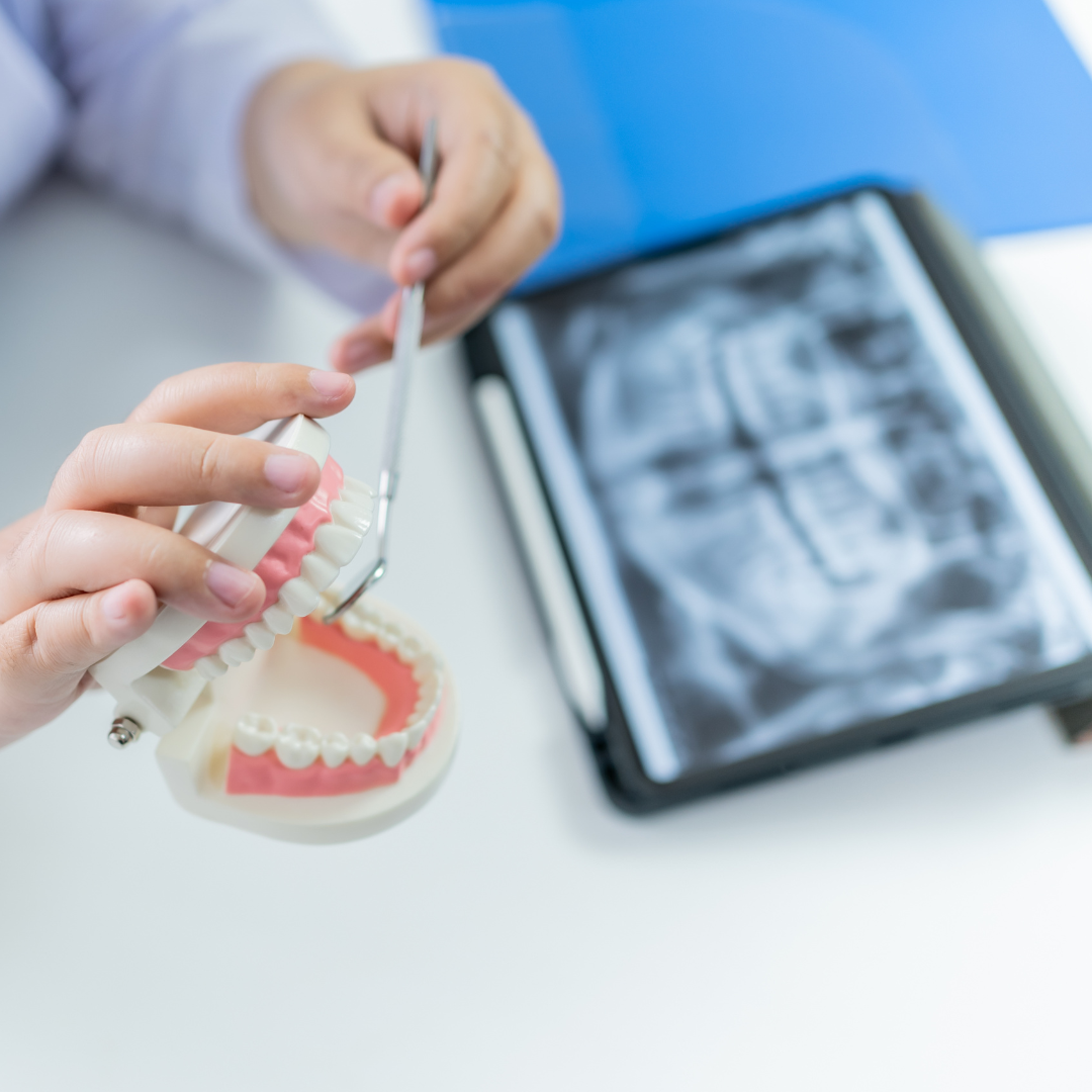 devitalizzazione denti