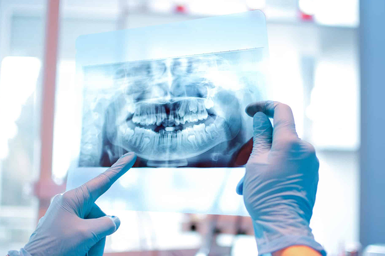 La Gnatologia odontoiatrica: di cosa si occupa?