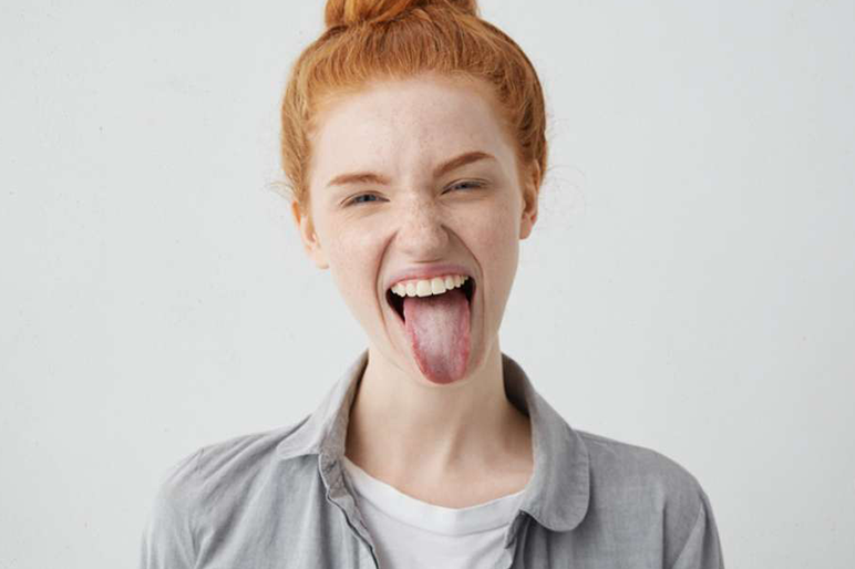 Lingua di colore bianco: bisogna preoccuparsi?