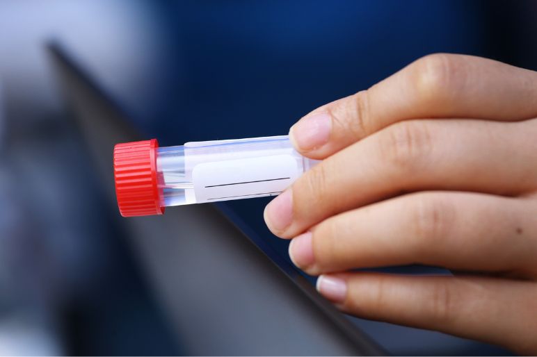 pH saliva: cos’è, perché è importante e come si misura