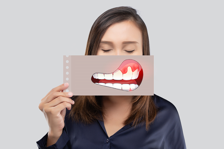 Prendersi cura delle gengive: perché è importante