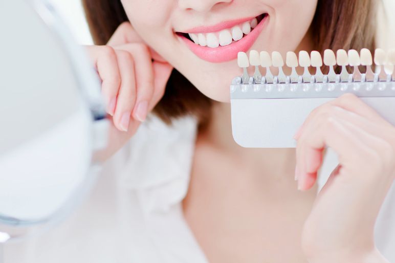Sbiancamento dentale Catania: fai brillare il tuo sorriso