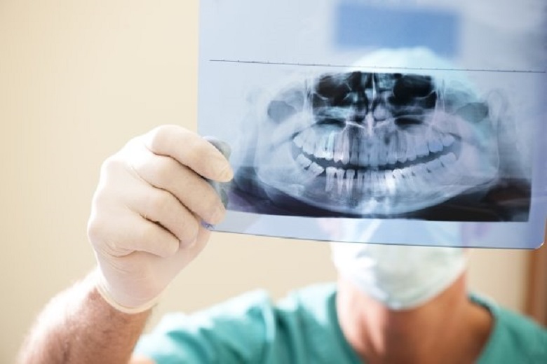 La “trappola” delle radiografie: quando il beneficio è in realtà un danno