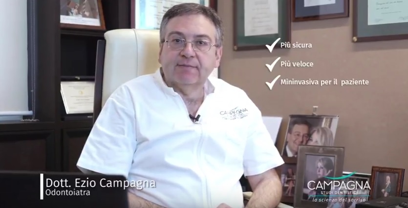 video vantaggi implantologia computer guidata Catania Ezio Campagna Dentista Catania