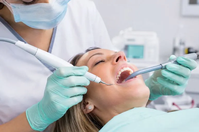 Ablazione tartaro: cos’è, quando farla e perché è fondamentale per la salute del sorriso
