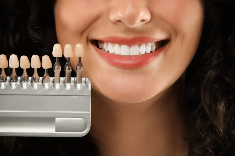 Da cosa dipende il colore dei denti? Tutto quello che c’è da sapere sul colore naturale del sorriso